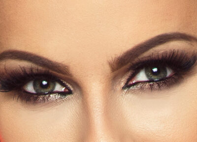 Woman's Eyes Post Eyelid Surgery