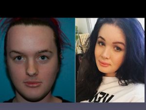 Before and After