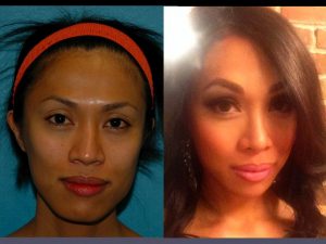Before & After