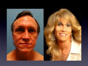 Before & After