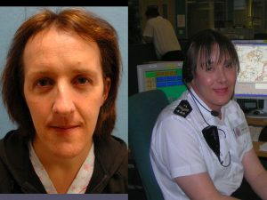 Pre Op and 2 Months Post Op after Full FFS