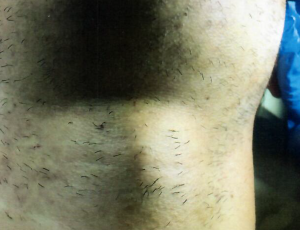 Patient 2 - After