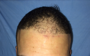 Before