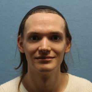 Pre-Op Patient in her 20s